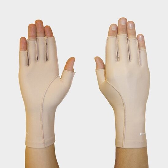 Edema more - 3/4 finger (compression class 15-25 mmHg)